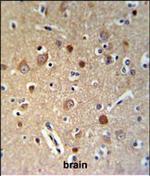 HSPA12A Polyclonal Antibody