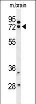 HSPA12A Antibody in Western Blot (WB)