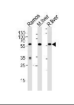 GPI Polyclonal Antibody