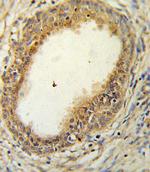 HAPLN1 Polyclonal Antibody