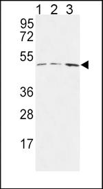 HAPLN1 Antibody in Western Blot (WB)