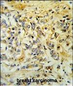 LMBR1L Polyclonal Antibody