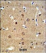 ADAM19 Polyclonal Antibody