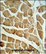 Calpain 3 Polyclonal Antibody