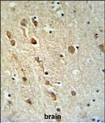 ZRANB1 Polyclonal Antibody