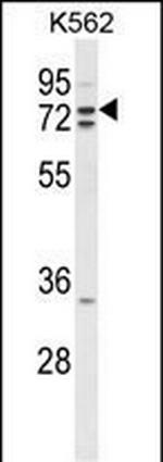 ZRANB1 Antibody in Western Blot (WB)