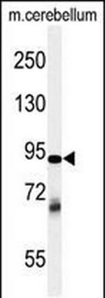 ZRANB1 Antibody in Western Blot (WB)