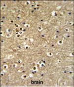 ETS2 Polyclonal Antibody