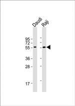 FCRL4 Antibody in Western Blot (WB)