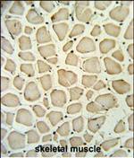 PGP Polyclonal Antibody