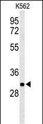 PGP Antibody in Western Blot (WB)