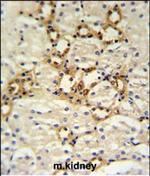 BSND Polyclonal Antibody