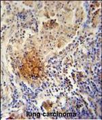 TYROBP Polyclonal Antibody