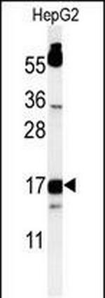TYROBP Antibody in Western Blot (WB)