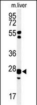 GSTK1 Antibody in Western Blot (WB)