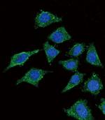 LCAT Polyclonal Antibody