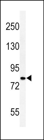 CDH20 Antibody in Western Blot (WB)