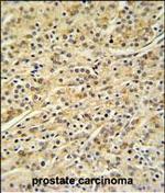 HOXA3 Polyclonal Antibody