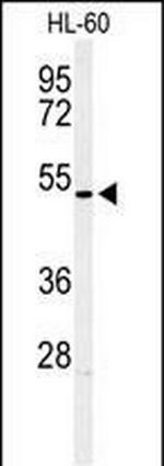 HOXA3 Antibody in Western Blot (WB)