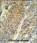 PYCR1 Polyclonal Antibody