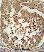 DIPK2A Polyclonal Antibody