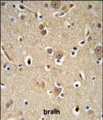 NEDD4 Polyclonal Antibody