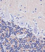 AMH Polyclonal Antibody