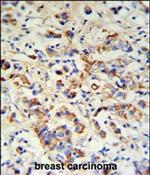 DCT Polyclonal Antibody