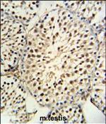 YPEL5 Polyclonal Antibody