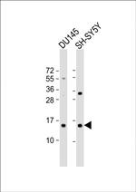 YPEL5 Antibody in Western Blot (WB)