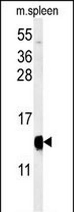 YPEL5 Antibody in Western Blot (WB)