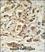 METTL17 Polyclonal Antibody