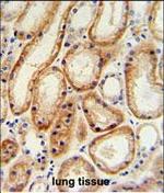 GALNT5 Polyclonal Antibody
