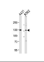 GALNT5 Antibody in Western Blot (WB)