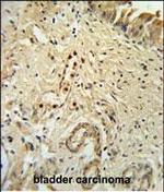 ID4 Polyclonal Antibody