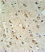 DNAJC6 Polyclonal Antibody