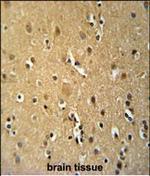 CD30 Polyclonal Antibody