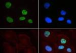 H3K9me2 Antibody in Immunocytochemistry (ICC/IF)