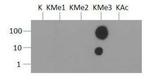 H3K36me3 Antibody in Dot Blot (DB)
