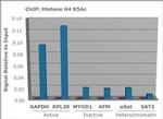 H4K5ac Antibody in ChIP Assay (ChIP)