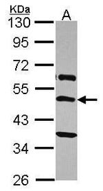 TRHR Antibody in Western Blot (WB)
