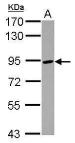 ADAM8 Polyclonal Antibody