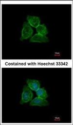 Annexin A13 Polyclonal Antibody