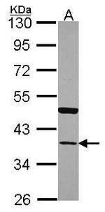 Annexin A13 Antibody in Western Blot (WB)