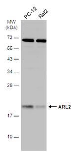 ARL2 Polyclonal Antibody