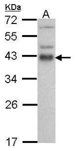 ATF1 Polyclonal Antibody
