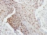Bcl-2 Antibody in Immunohistochemistry (Paraffin) (IHC (P))