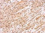 BRIP1 Antibody in Immunohistochemistry (Paraffin) (IHC (P))