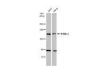 BRIP1 Antibody in Western Blot (WB)