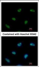RAD9 Antibody in Immunocytochemistry (ICC/IF)